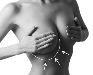 Chirurgie Seins Tunisie Lifting Mammaire