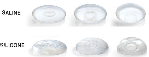 types-implant-mammaires